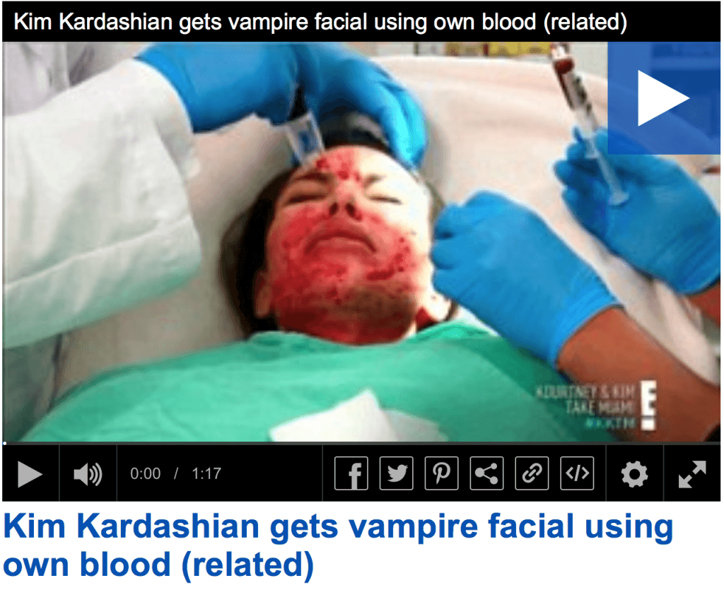 Bildet er hentet fra: http://www.dailymail.co.uk/video/tvshowbiz/video-1001970/Kim-Kardashian-gets-vampire-facial-using-blood.html