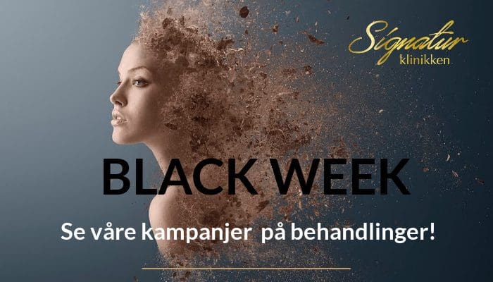 Black Week Behandlinger Nettbutikk