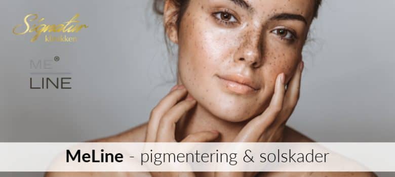 MeLine behandling av pigmentering og solskader Signaturklinikken Beautyblogg